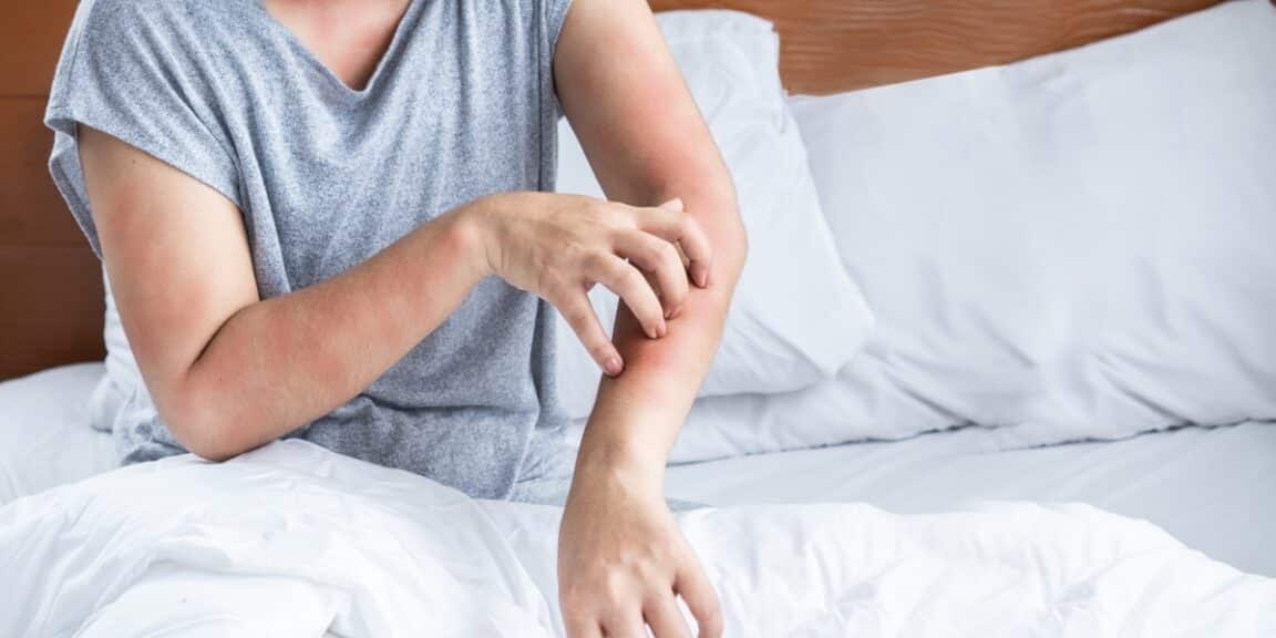 La lutte contre les acariens : comment garder sa maison allergène-free